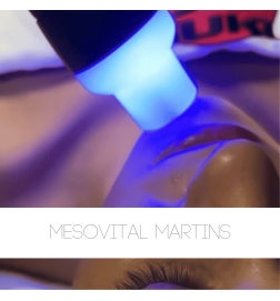 Mesovital Martins