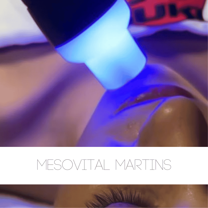 Mesovital Martins