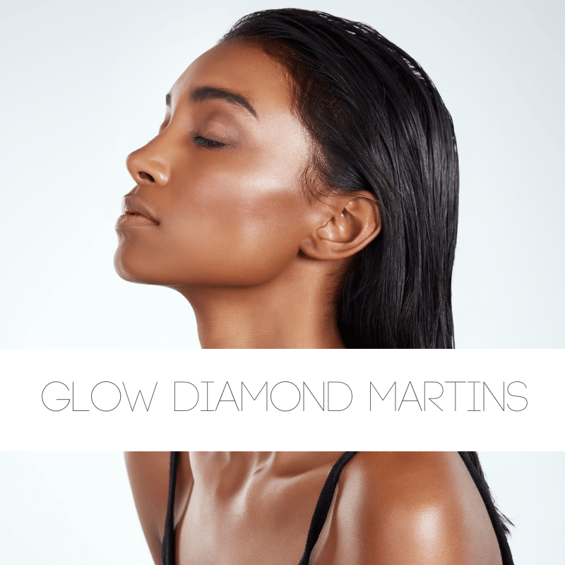 Glow Diamond Martins