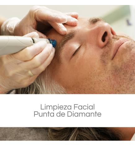 Limpieza Facial con Punta de Diamante