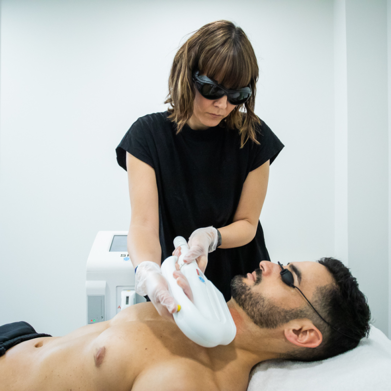 Antebrazos Depilacion Laser Brazos Hombre ?Depilación Láser De