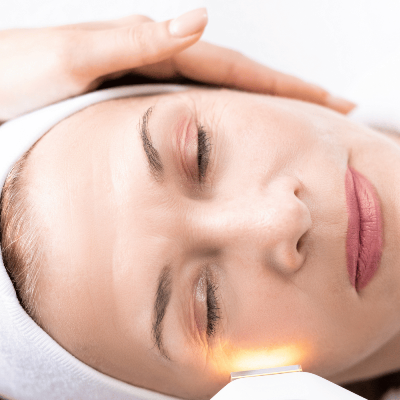 FOTOREJUVENECIMIENTO FACIAL LASER EN BURGOS