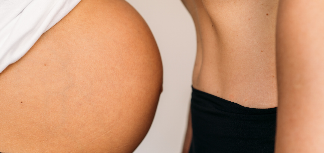 Hipopresivos, ¿sí o no? Lo que deberías saber desde la fisioterapia